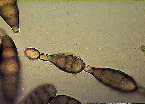 What Is Alternata Tenuis? – Alternaria Taxonomy: Historical ...